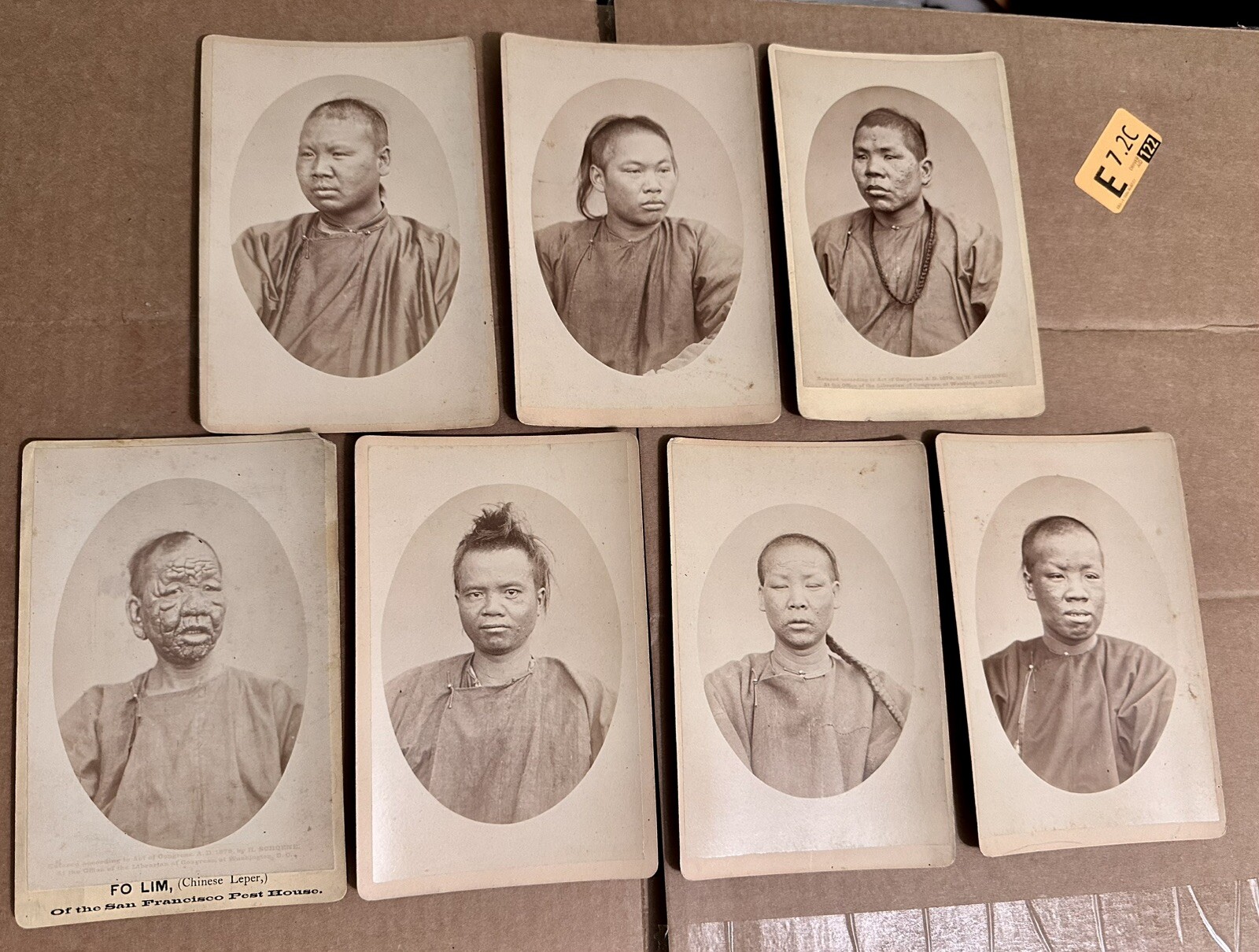 HISTORICALLY SIGNIFICANT CHINESE LEPERS SAN FRANCISCO RARE MEDICINE 19th Century HISTORICALLY SIGNIFICANT CHINESE LEPERS SAN FRANCISCO RARE MEDICINE 19th Century