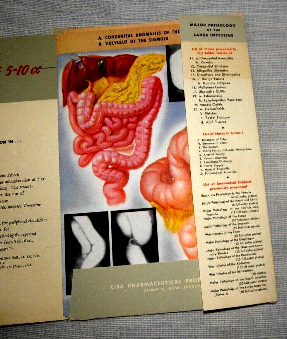 20 COLORED SUPERB PLATES MAJOR PATHOLOGY OF THE SMALL LARGE INTESTINE CIBA 1945 20 COLORED SUPERB PLATES MAJOR PATHOLOGY OF THE SMALL LARGE INTESTINE CIBA 1945